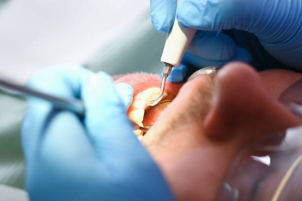 Best Emergency Dentist for Special Needs Patients in Morrisonvle, IL